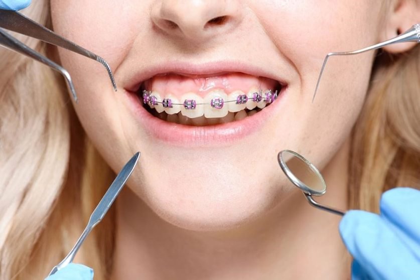 Orthodontic Treatment