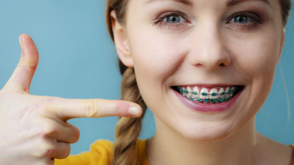 Orthodontic specialists of Florida