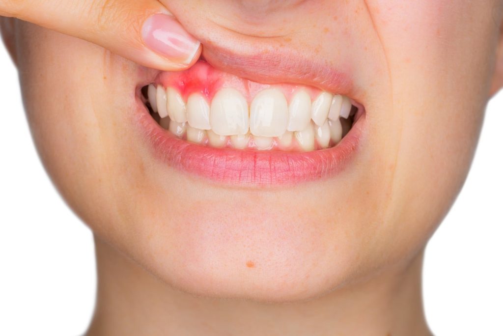 treatment for tooth infection